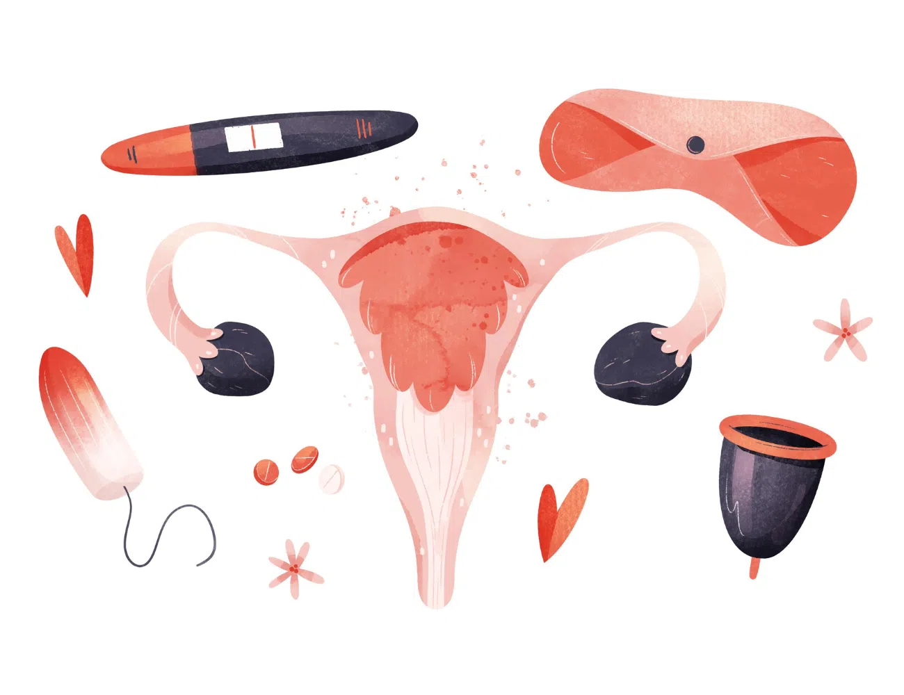Premenstruációs szindróma: segíthet a myo-inozitol? Premenstruációs szindróma: segíthet a myo-inozitol?